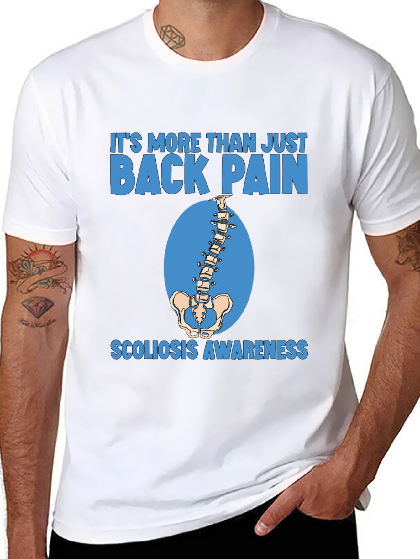Scoliosis Awareness T-Shirt - More Than Back Pain