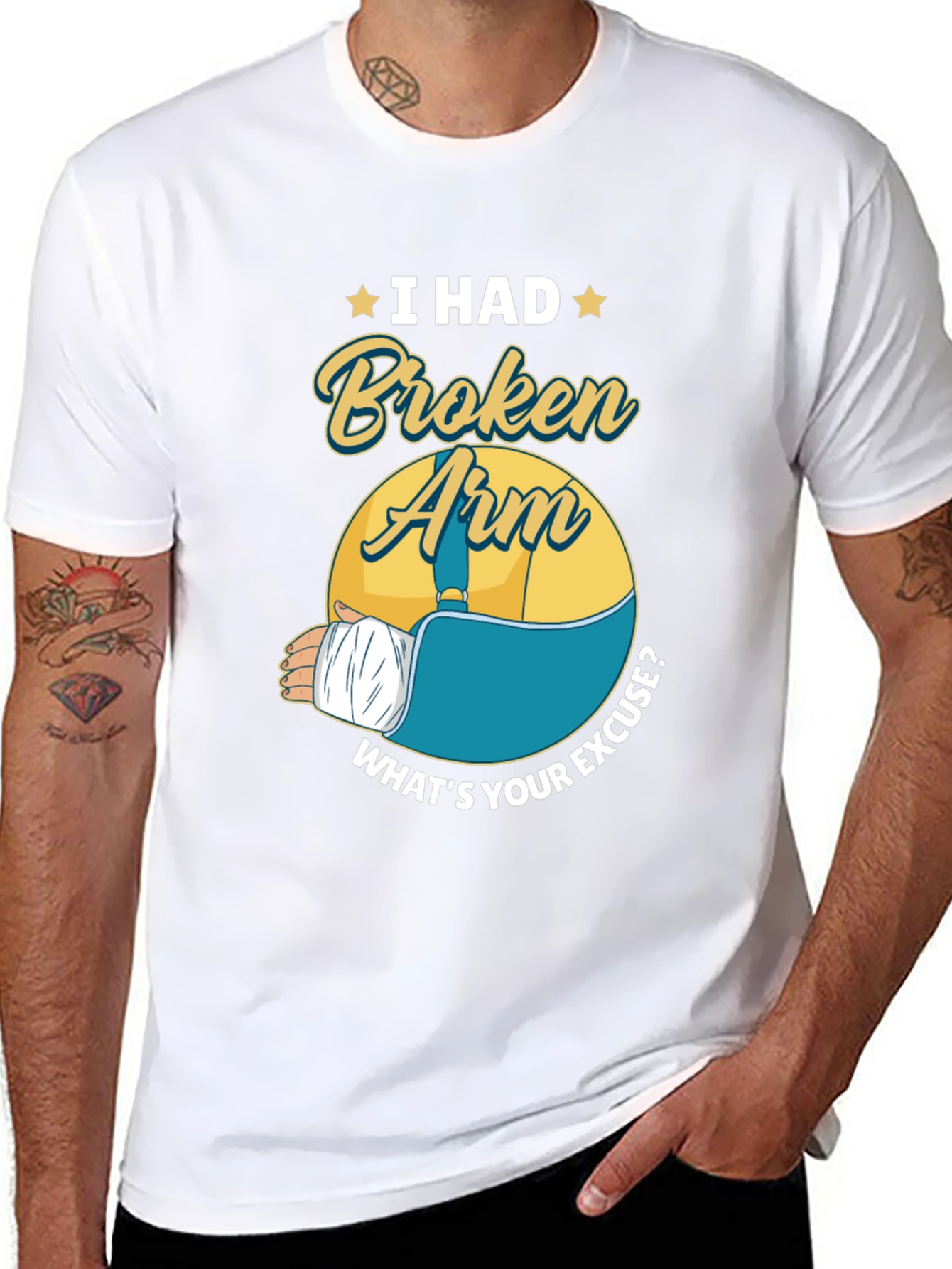 I Had a Broken Arm Graphic Tee